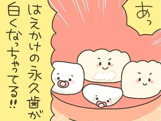 次女、初めての歯医者へ[10年ぶりに出産しました#333]