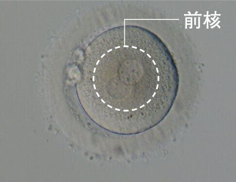 正常な受精卵（胚といいます）は、卵子と精子由来の前核と呼ばれる遺伝子情報を持つ部分が2つ確認できます。採卵の翌日に確認でき、この胚は2PN胚と呼ばれます。
