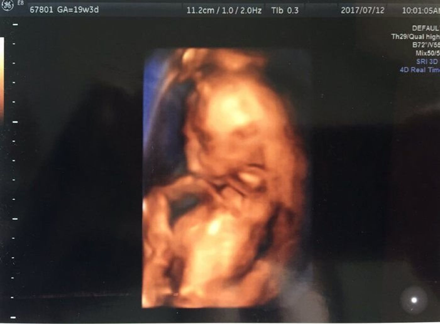 セットする 奇跡的な 相反する 19 週 目 Maxsystem Jp セットする 奇跡的な 相反する 19 週 目 Maxsystem Jp