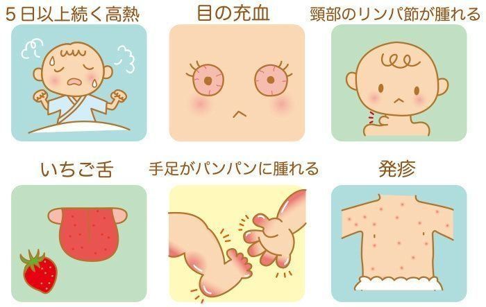 原因不明の赤ちゃんの病気 川崎病の症状とケア 医師監修 たまひよ
