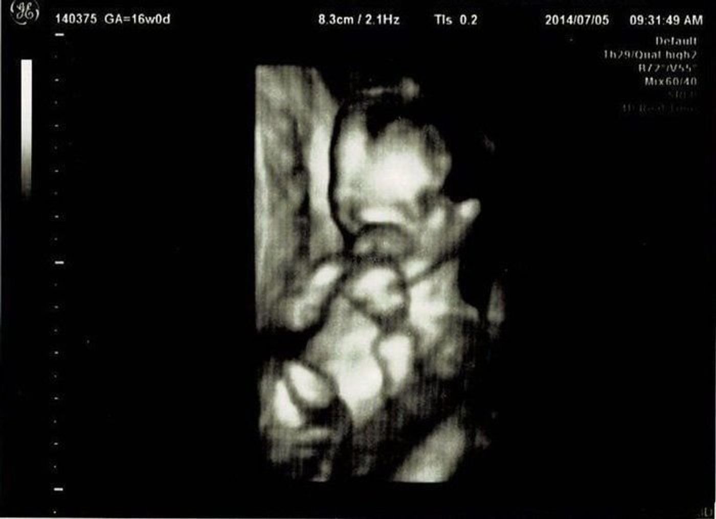 妊娠16週 赤ちゃんのエコー写真 超音波写真まとめ たまひよ 妊娠16週 赤ちゃんのエコー写真 超音波写真まとめ たまひよ
