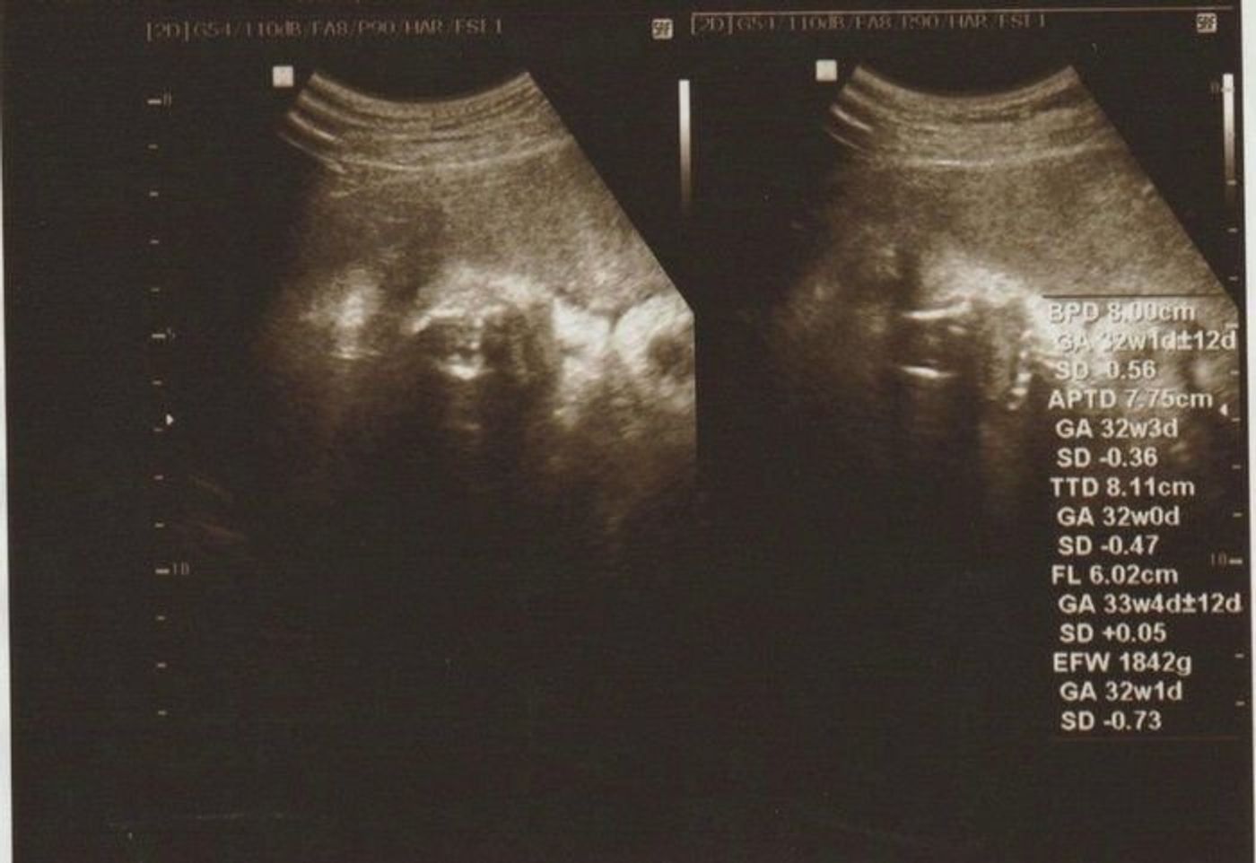 妊娠33週 赤ちゃんのエコー写真 超音波写真まとめ たまひよ 妊娠33週 赤ちゃんのエコー写真 超音波写真まとめ たまひよ