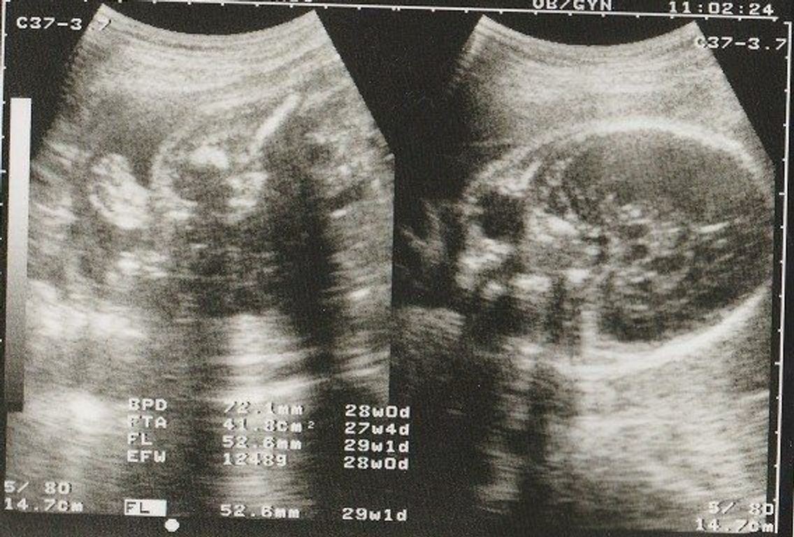 妊娠29週 赤ちゃんのエコー写真 超音波写真まとめ たまひよ 妊娠29週 赤ちゃんのエコー写真 超音波写真まとめ たまひよ