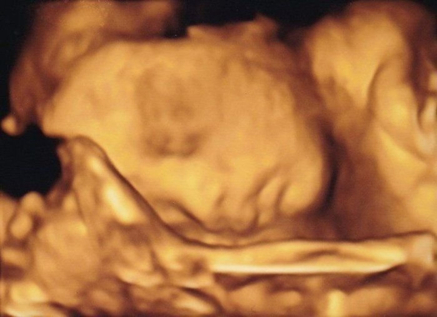 妊娠28週 赤ちゃんのエコー写真 超音波写真まとめ たまひよ 妊娠28週 赤ちゃんのエコー写真 超音波写真まとめ たまひよ