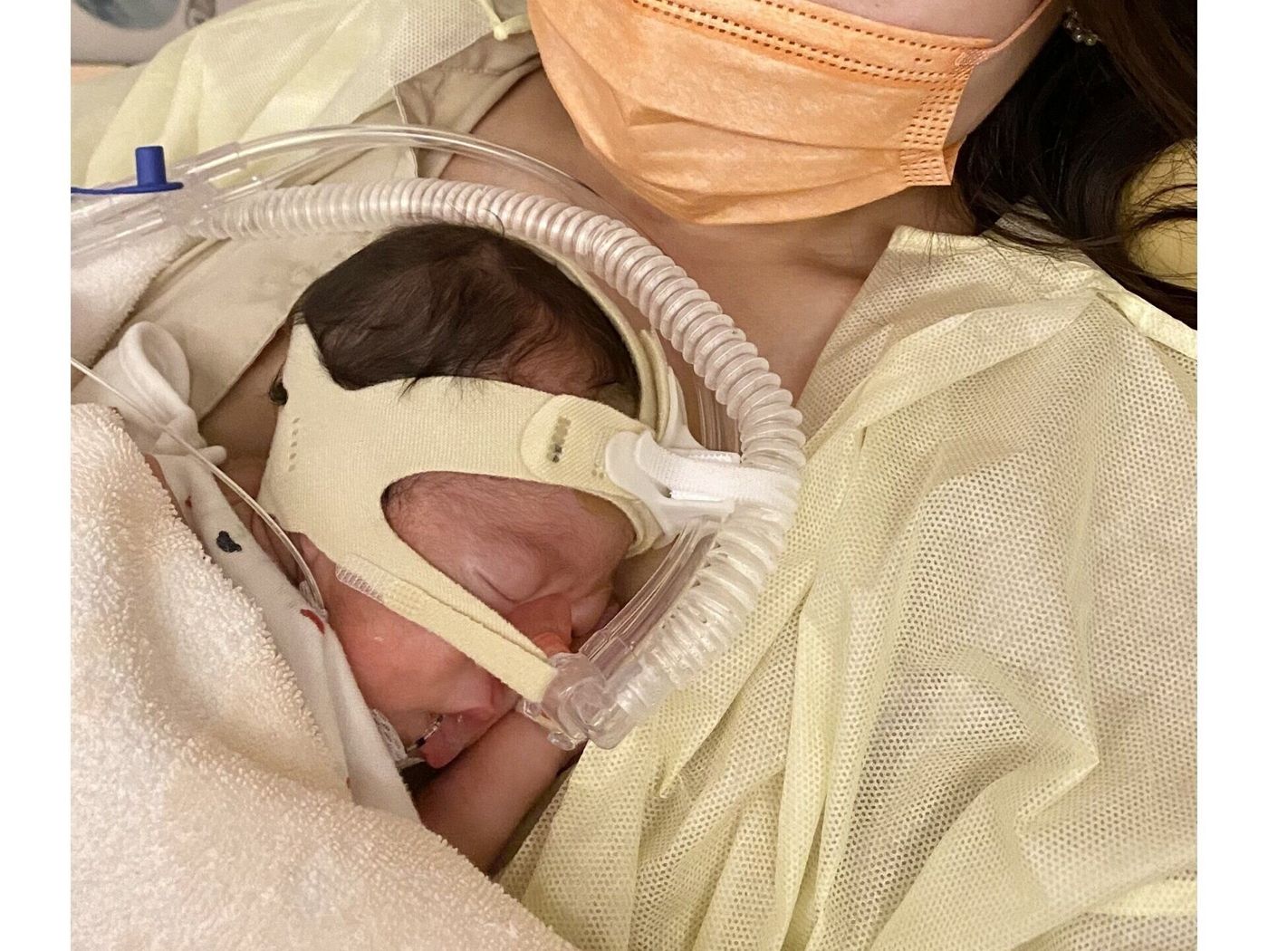 コロナ禍に558gで生まれた小さな命 はじめてのおむつは 低出生体重児用の6sサイズ 今はそれが家族の宝物に 体験談 医師監修 たまひよ コロナ禍に558gで生まれた小さな命 はじめてのおむつは 低出生体重児用の6sサイズ 今はそれが家族の宝物に 体験談 医師監修 たまひよ