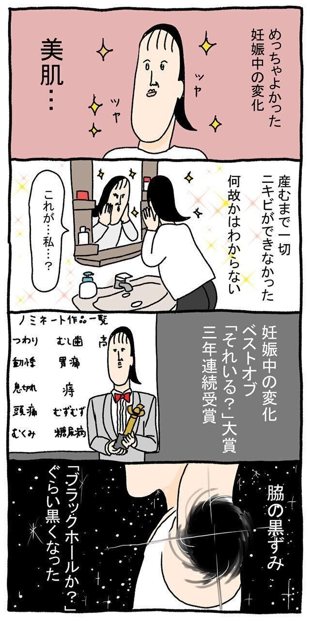ツボウチさん 「それいる?」大賞 脇の黒ずみ