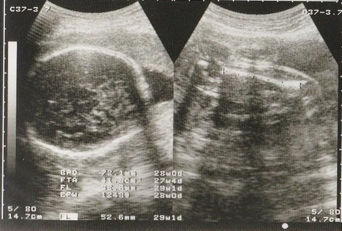 妊娠29週 赤ちゃんのエコー写真 超音波写真まとめ たまひよ 妊娠29週 赤ちゃんのエコー写真 超音波写真まとめ たまひよ