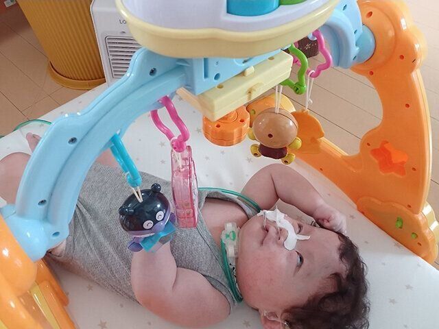 双子の医療的ケア児育児体験談　チャージ症候群・免疫不全・弱視難聴