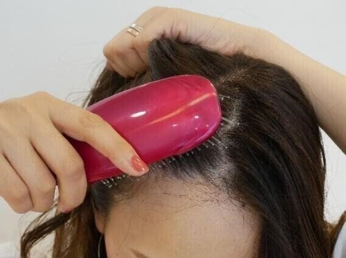 約8割のママが産後の 抜け毛 に悩んでいる その対策は 専門家 たまひよ 約8割のママが産後の 抜け毛 に悩んでいる その対策は 専門家 たまひよ