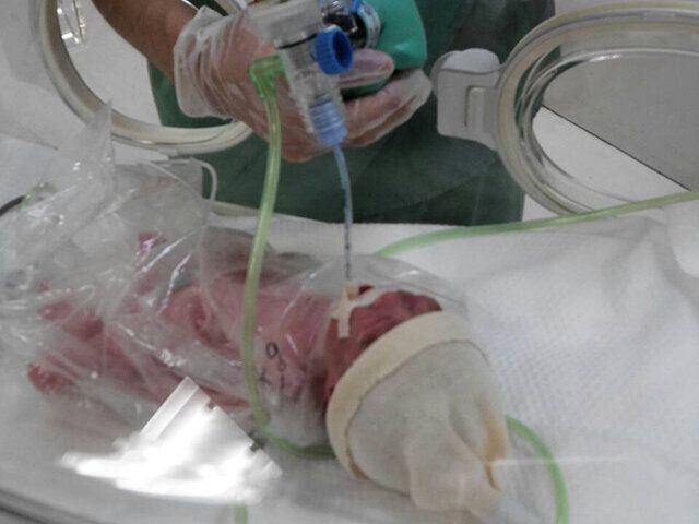 ダウン症の双子 優馬君と風馬君 「NPO法人つなぐ」桐淵良美さんインタビュー