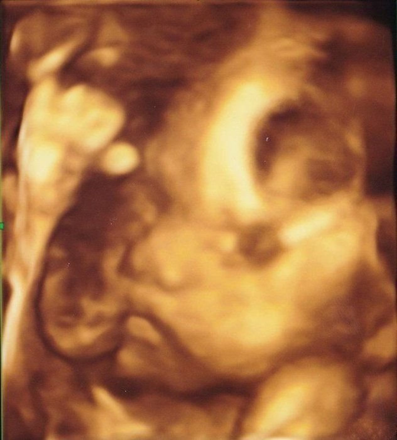 妊娠24週 赤ちゃんのエコー写真 超音波写真まとめ たまひよ 妊娠24週 赤ちゃんのエコー写真 超音波写真まとめ たまひよ