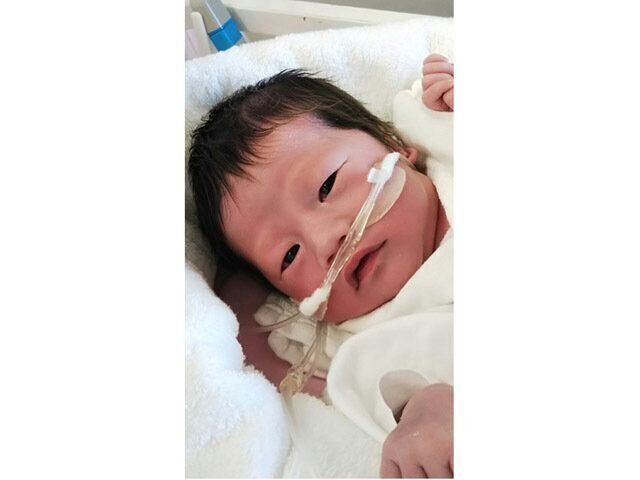 新生児、ピットホプキンス