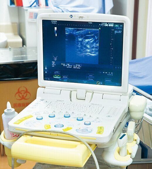 精巣内部など、視診・触診ができない部分は超音波で検査。受診者も目で見えるので安心感があります。