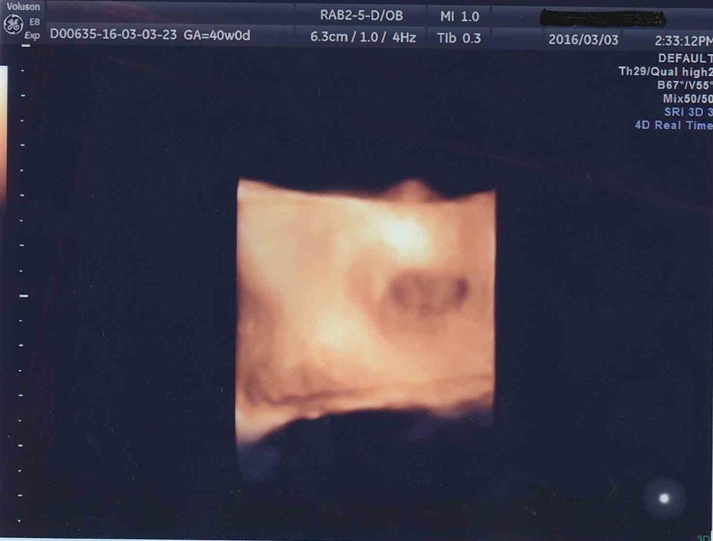4dエコーで初めて見たわが子の顔 先生が撮った最高の1枚 たまひよ 4dエコーで初めて見たわが子の顔 先生が撮った最高の1枚 たまひよ