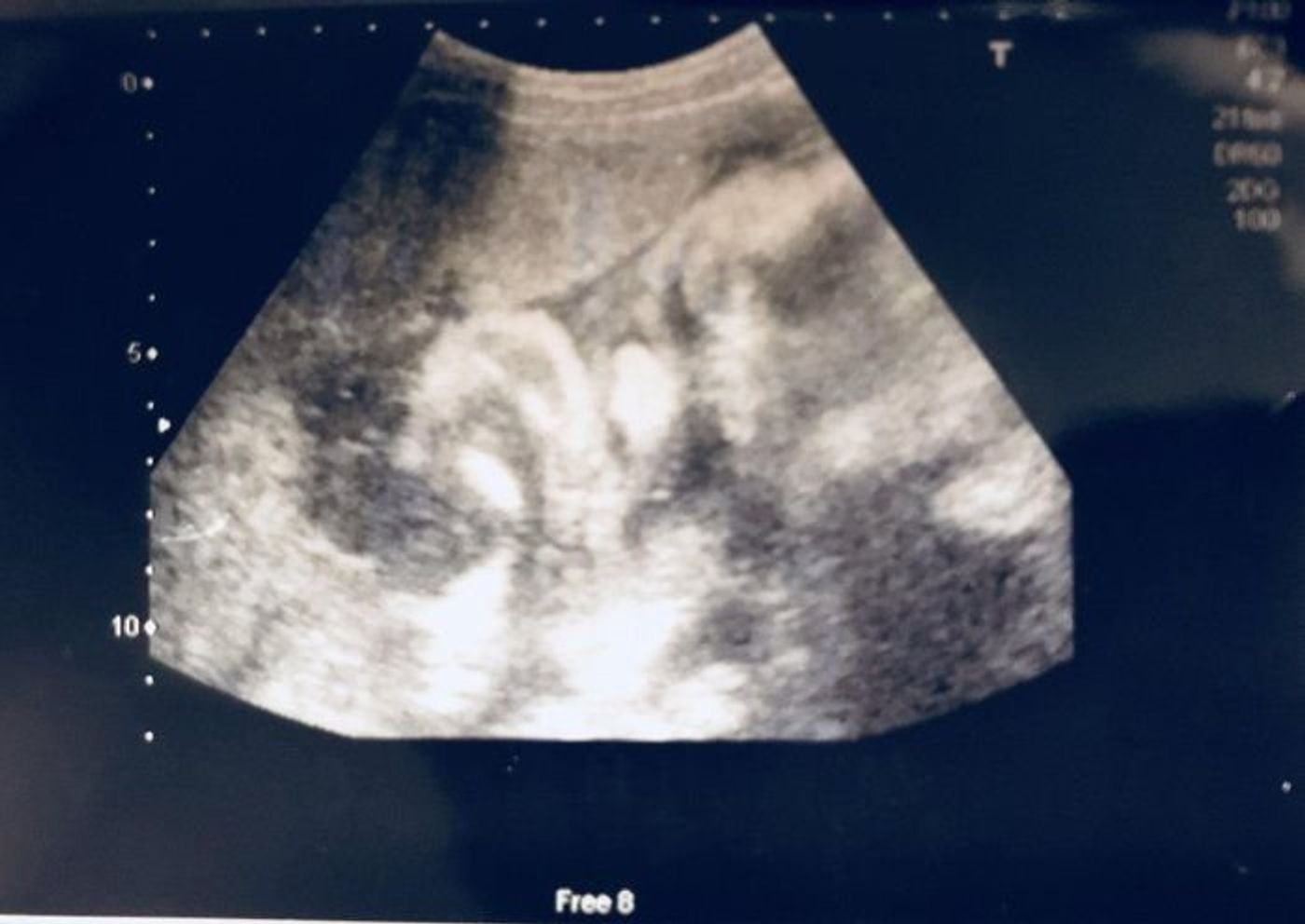 妊娠35週 赤ちゃんのエコー写真 超音波写真まとめ たまひよ 妊娠35週 赤ちゃんのエコー写真 超音波写真まとめ たまひよ