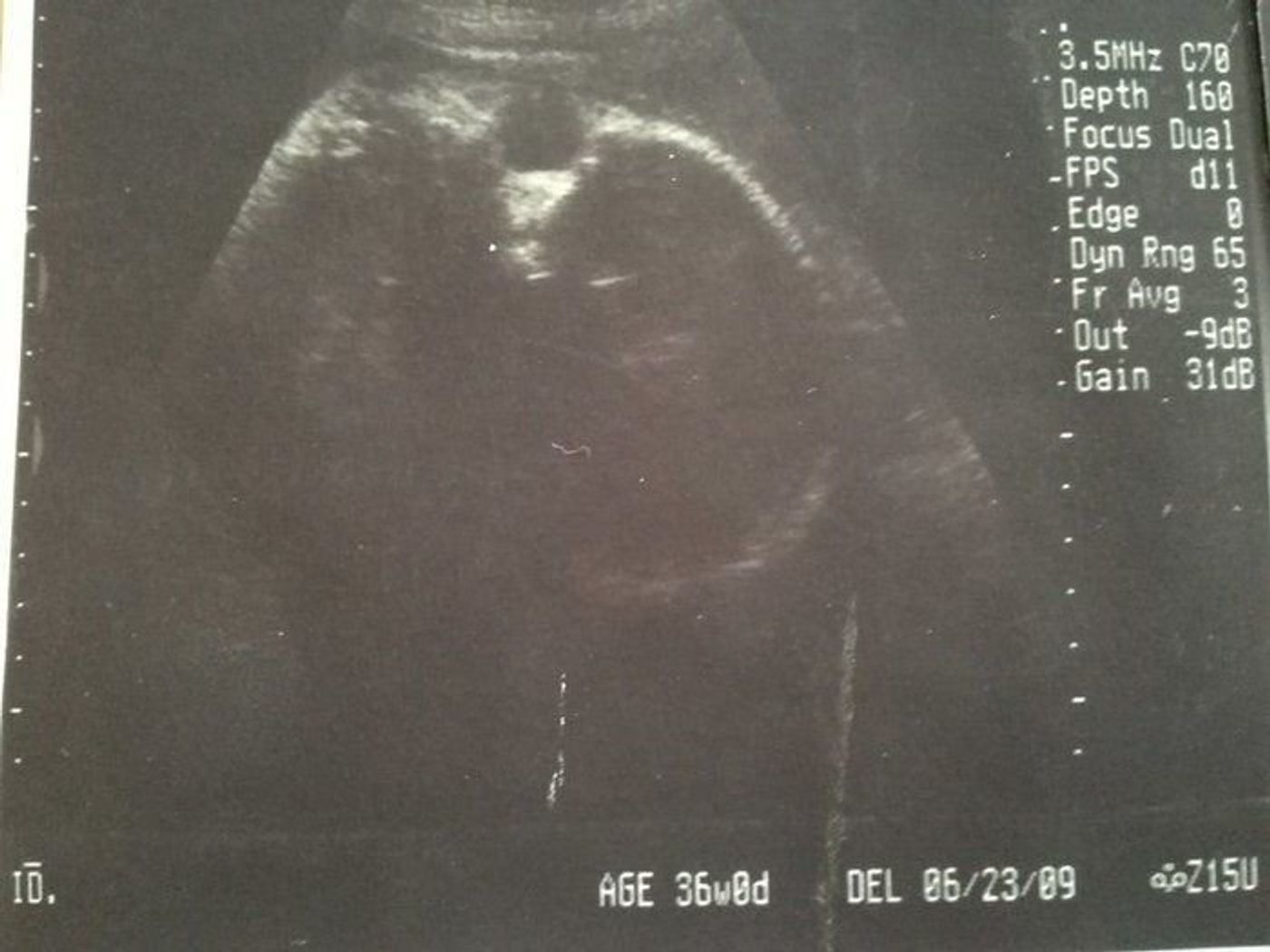 妊娠36週 赤ちゃんのエコー写真 超音波写真まとめ たまひよ 妊娠36週 赤ちゃんのエコー写真 超音波写真まとめ たまひよ