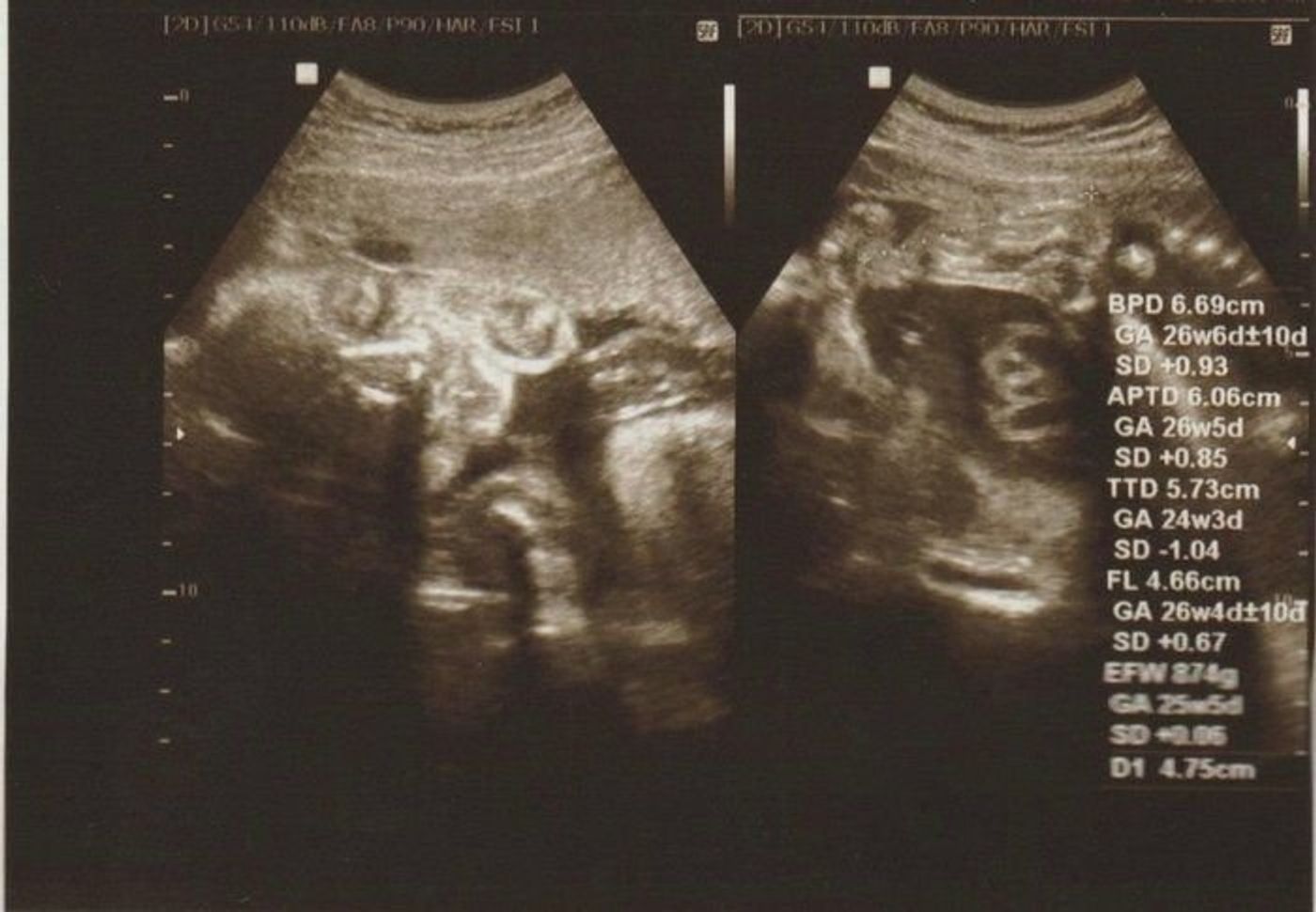 妊娠25週 赤ちゃんのエコー写真 超音波写真まとめ たまひよ 妊娠25週 赤ちゃんのエコー写真 超音波写真まとめ たまひよ