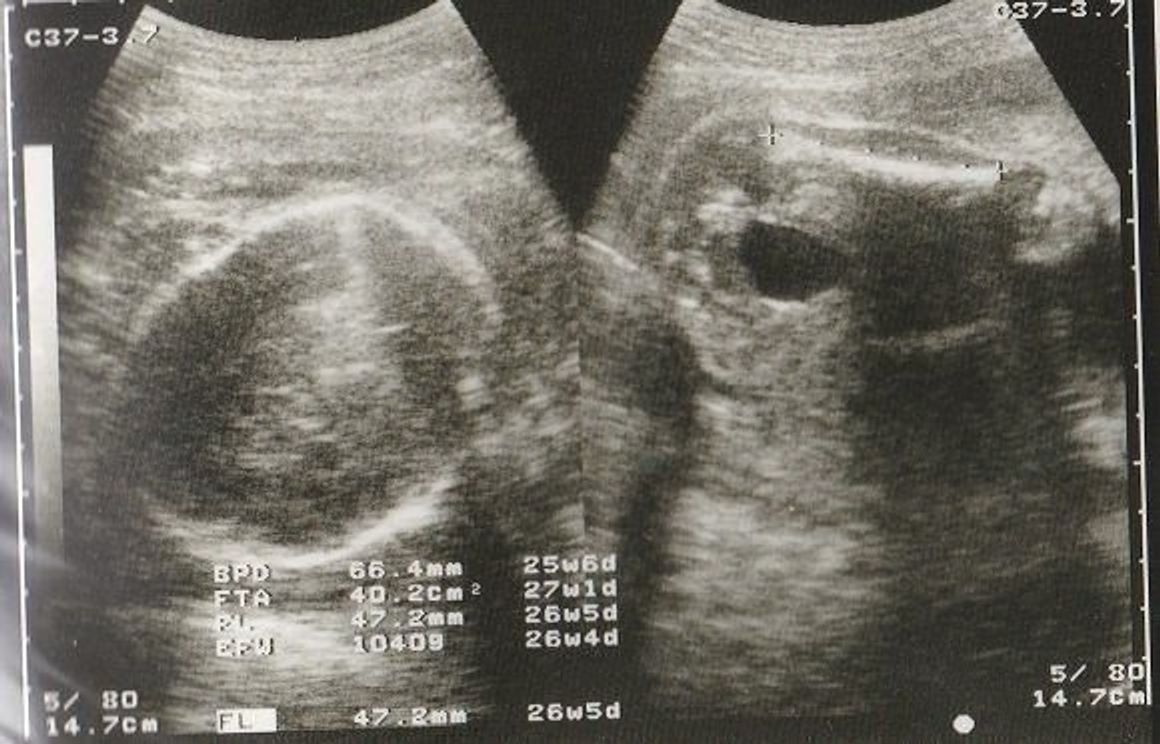 妊娠26週 赤ちゃんのエコー写真 超音波写真まとめ たまひよ 妊娠26週 赤ちゃんのエコー写真 超音波写真まとめ たまひよ