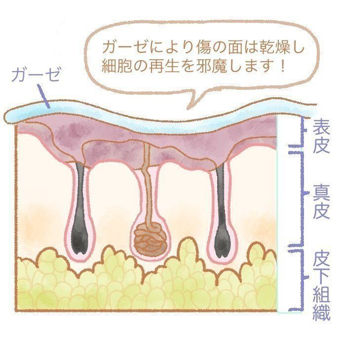 切り傷・すり傷は消毒しない!乾かさない!新しい考え方【日本外来小児科学会リーフレット検討会より】|たまひよ