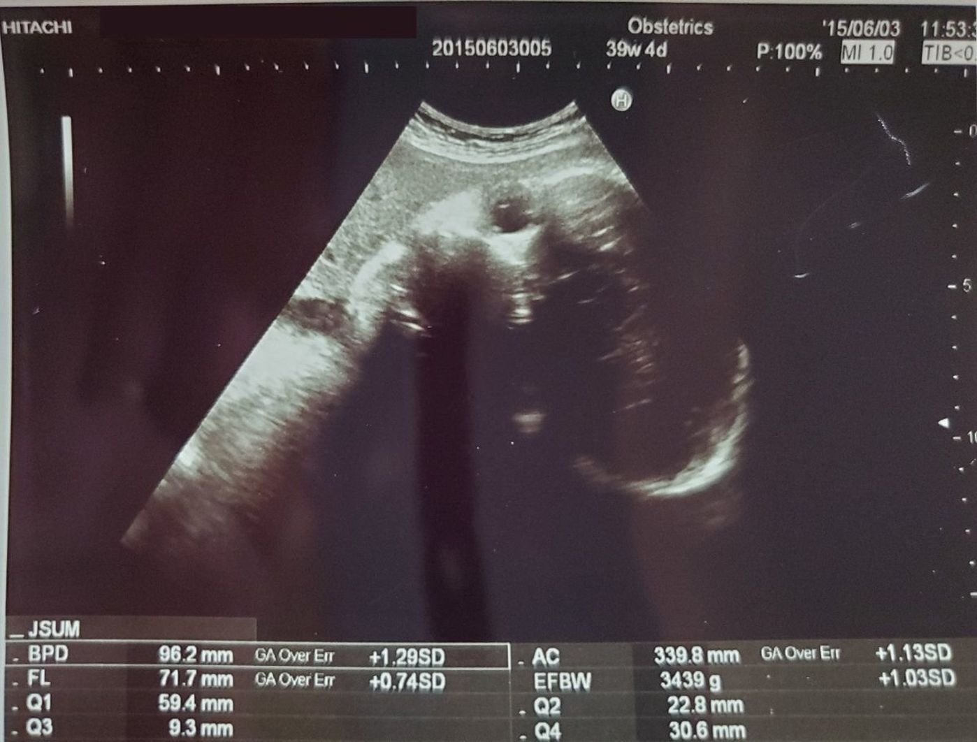 高齢 初出産でドキドキ エコー写真で振り返る成長の軌跡 たまひよ 高齢 初出産でドキドキ エコー写真で振り返る成長の軌跡 たまひよ