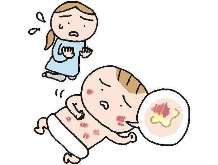 医師監修 赤ちゃんの肌にトラブルが起きた原因 病院へ行く前に確認すること 受診の目安やホームケア たまひよ