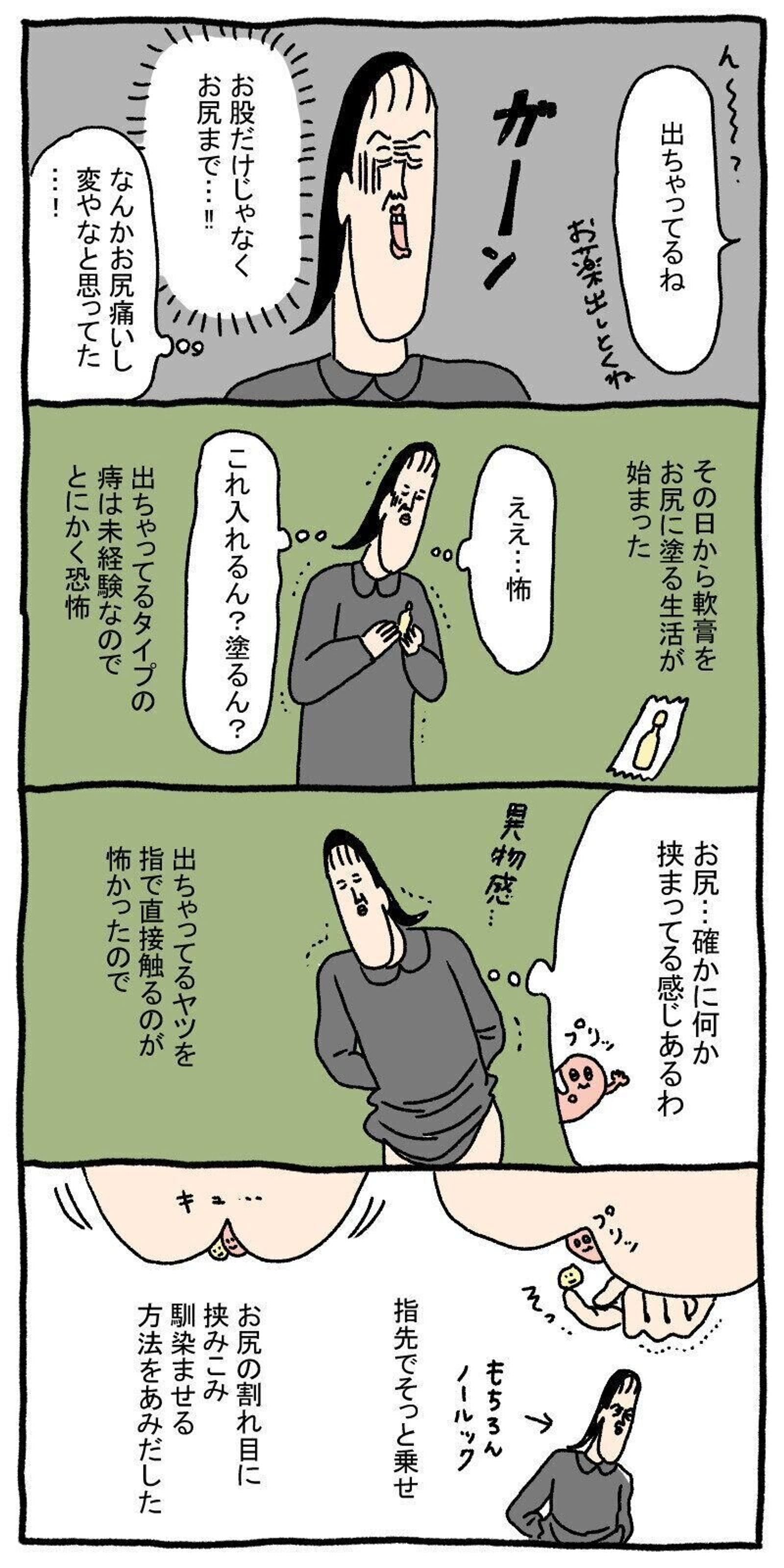 産後初内診で発見 アレ のその後 ツボウチ出産劇場 17 たまひよ 産後初内診で発見 アレ のその後 ツボウチ出産劇場 17 たまひよ