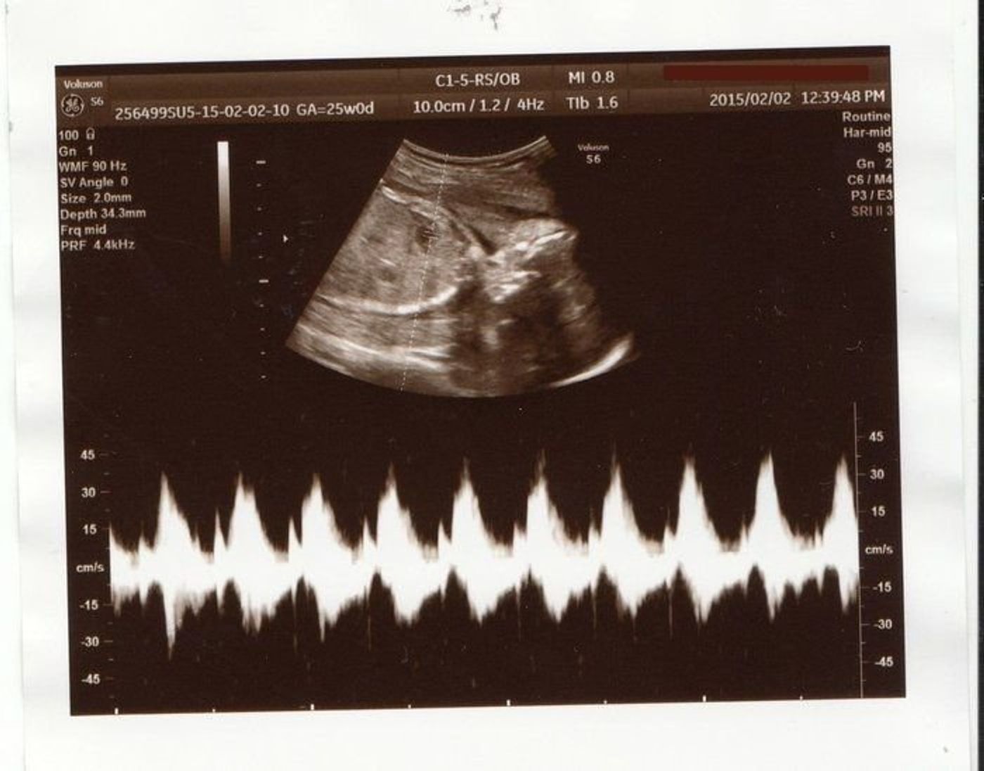 妊娠25週 赤ちゃんのエコー写真 超音波写真まとめ たまひよ 妊娠25週 赤ちゃんのエコー写真 超音波写真まとめ たまひよ