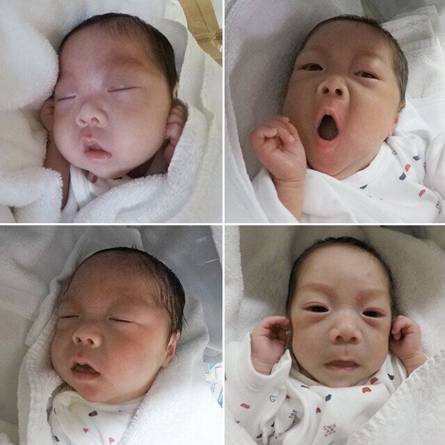 ４つ子妊娠出産体験談よつはさん　新生児