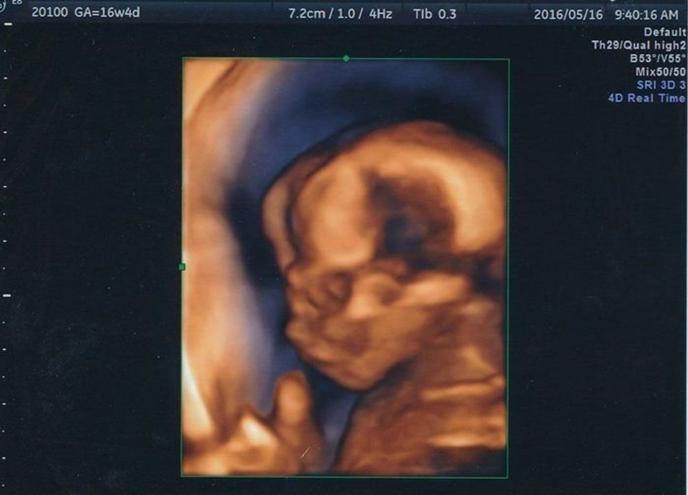 妊娠16週 赤ちゃんのエコー写真 超音波写真まとめ たまひよ 妊娠16週 赤ちゃんのエコー写真 超音波写真まとめ たまひよ
