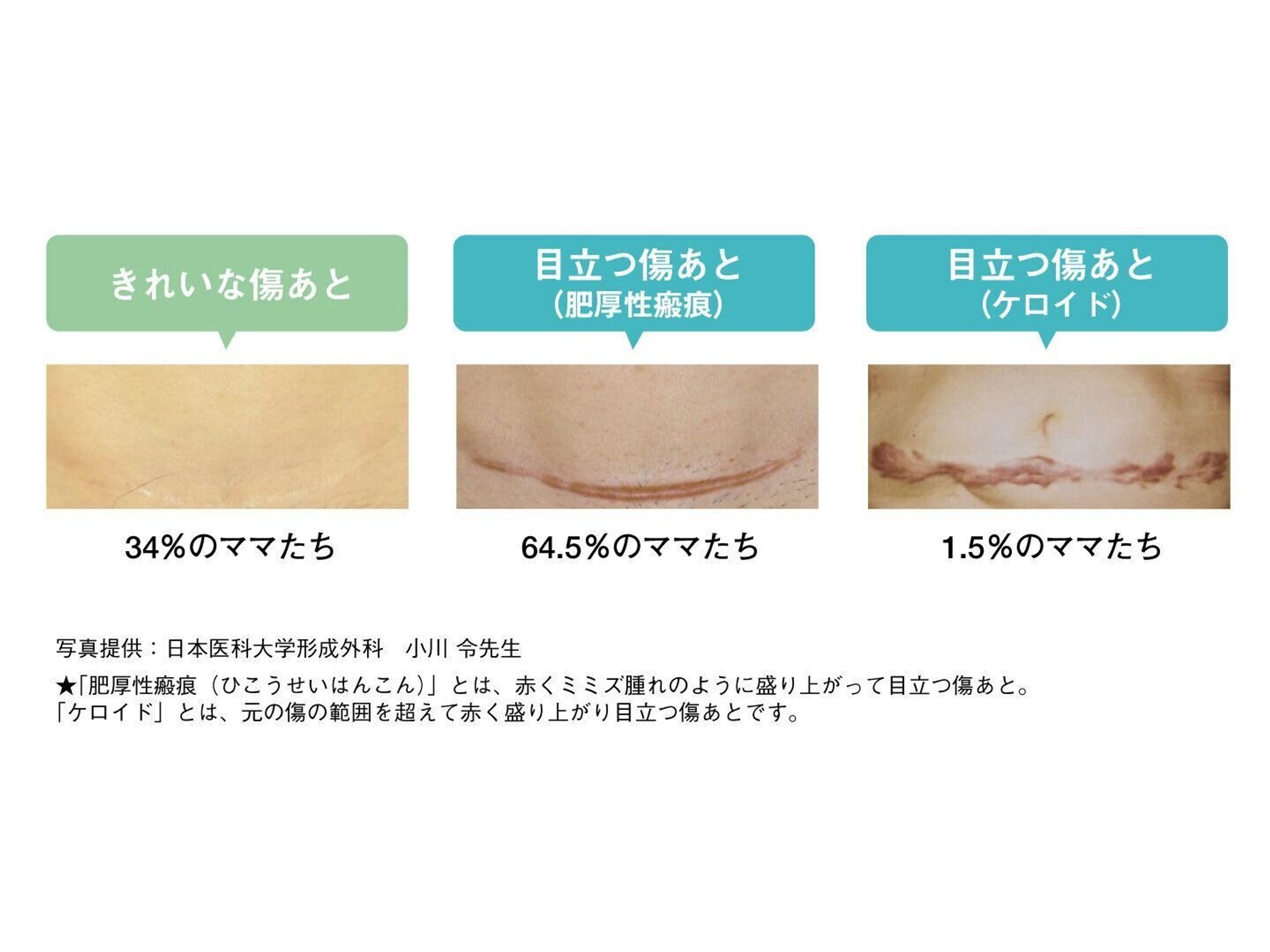 当時のメディア報道・掲載写真