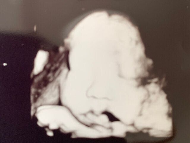 医療的ケア児育児・出産体験談　仲谷さやかさんインタビュー