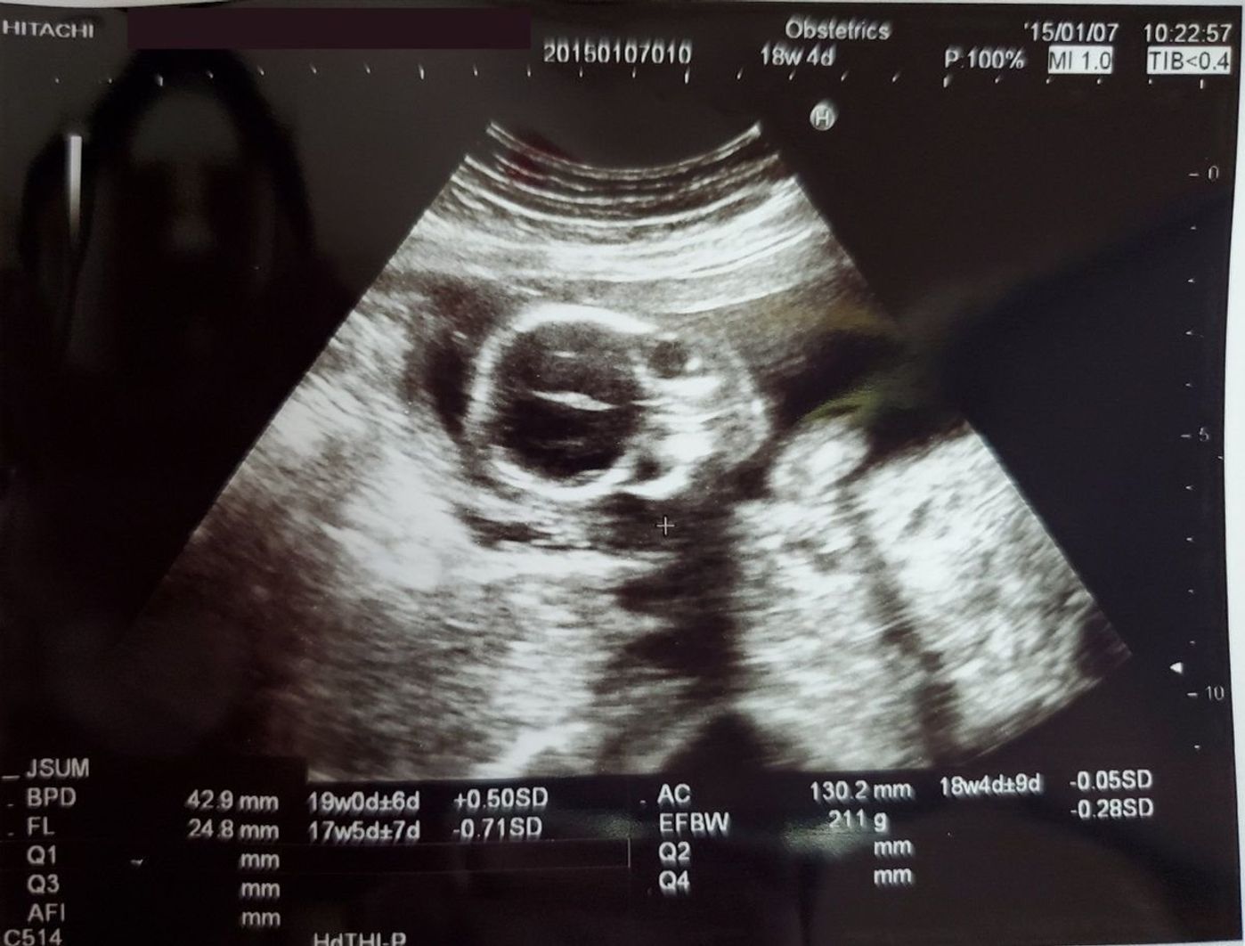 高齢 初出産でドキドキ エコー写真で振り返る成長の軌跡 たまひよ 高齢 初出産でドキドキ エコー写真で振り返る成長の軌跡 たまひよ