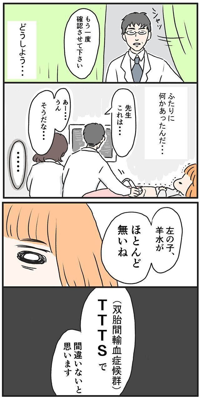 双子妊娠・出産体験談　さゆりさん“双胎間輸血症候群”になった話