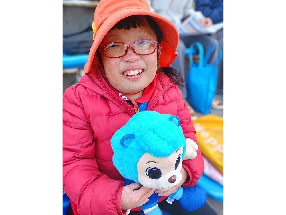 ロスムンド・トムソン症候群と診断された12歳のころのひーちゃん