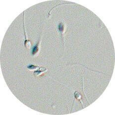 精液検査では精液の量や精子の数、運動率、奇形率などを調べます。