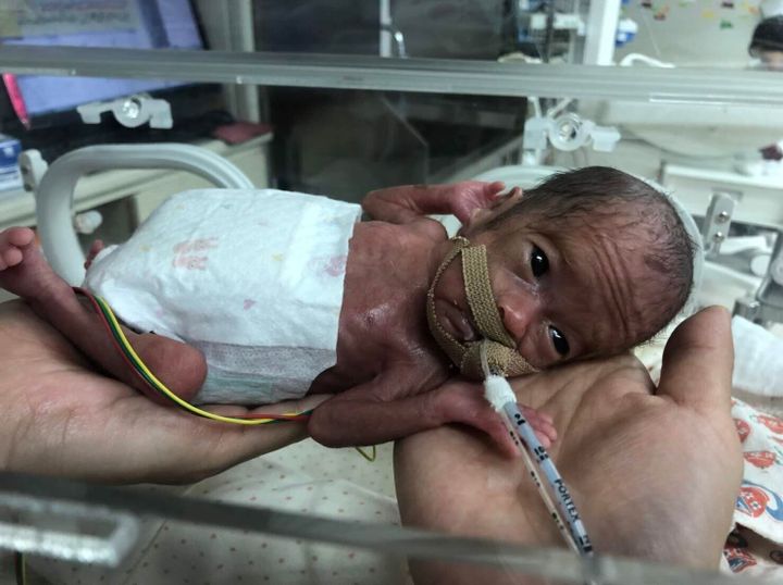 わずか体重370gで生まれたわが子 何があってもこの子と生きていこう 手足をバタバタ動かしている姿を見て胸が熱く 体験談 たまひよ わずか体重370gで生まれたわが子 何があってもこの子と生きていこう 手足をバタバタ動かしている姿を見て胸が熱く 体験談 たまひよ