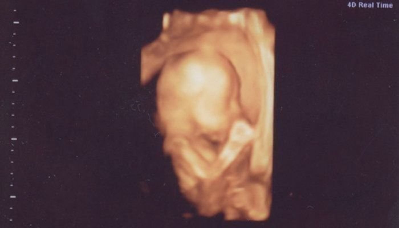 妊娠22週 赤ちゃんのエコー写真 超音波写真まとめ たまひよ 妊娠22週 赤ちゃんのエコー写真 超音波写真まとめ たまひよ
