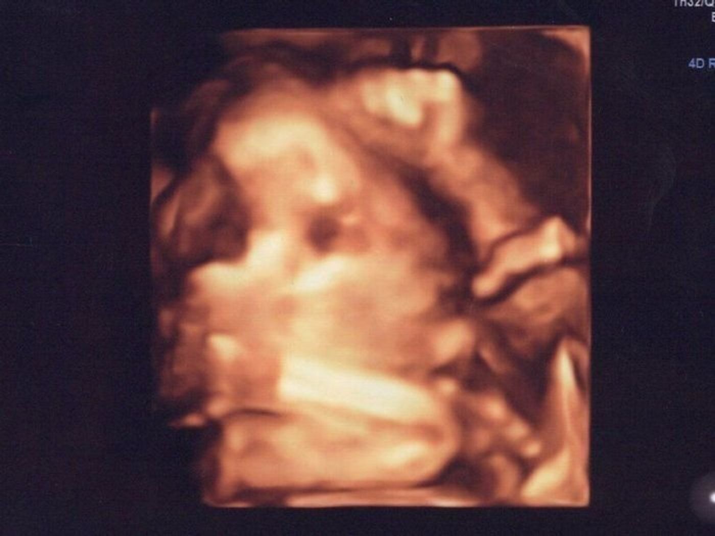 妊娠21週 赤ちゃんのエコー写真 超音波写真まとめ たまひよ 妊娠21週 赤ちゃんのエコー写真 超音波写真まとめ たまひよ