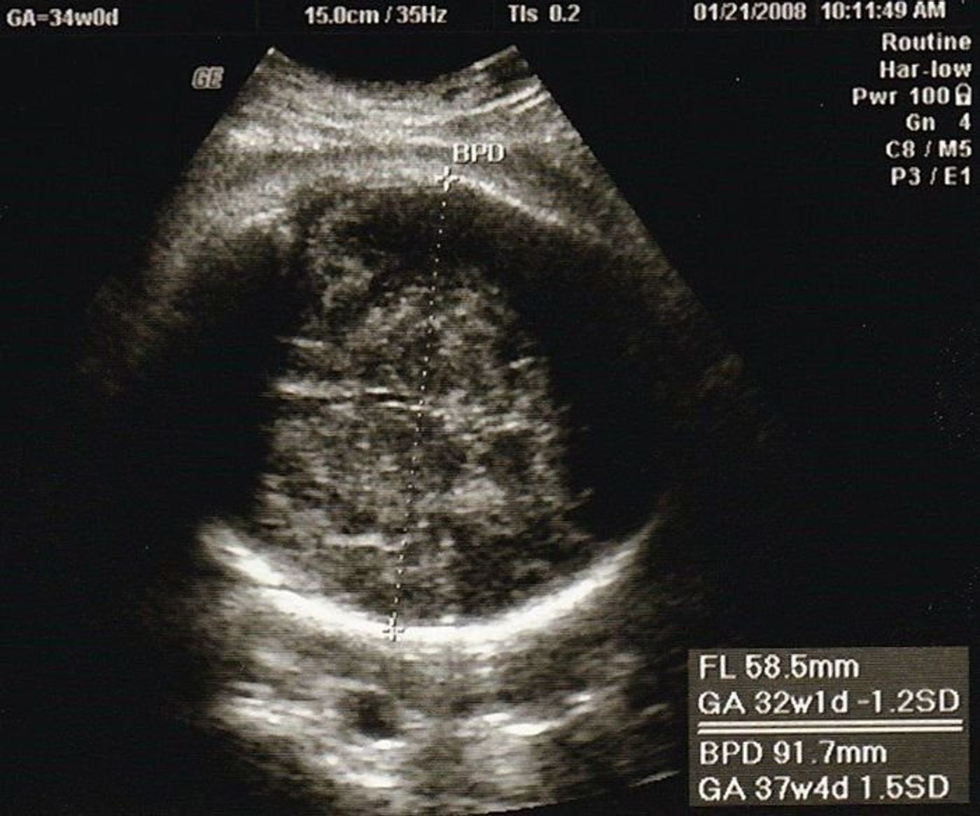 妊娠34週 赤ちゃんのエコー写真 超音波写真まとめ たまひよ 妊娠34週 赤ちゃんのエコー写真 超音波写真まとめ たまひよ