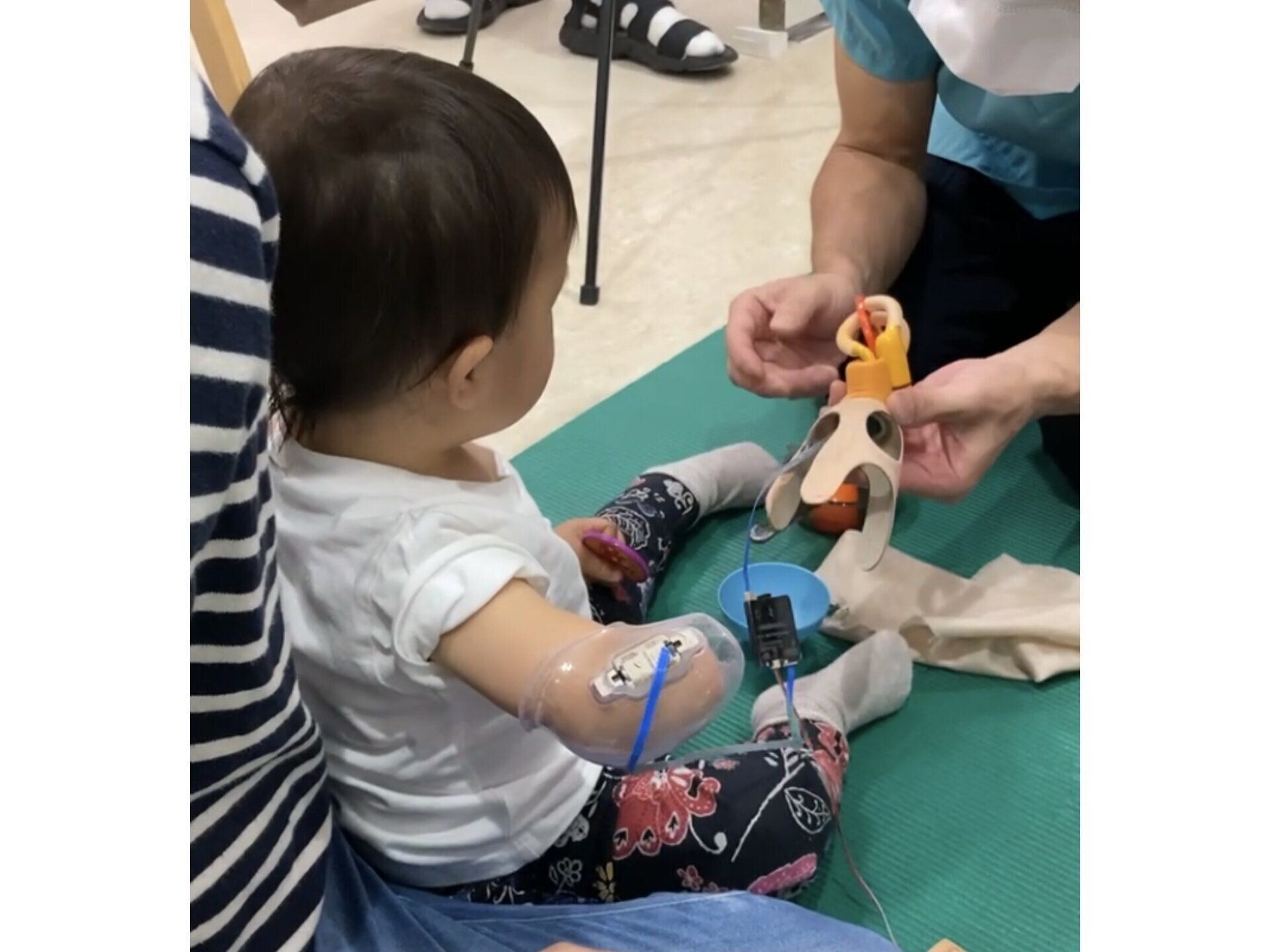 右前腕欠損で生まれた長女｡｢腕を隠すことは絶対しない｣と決めて