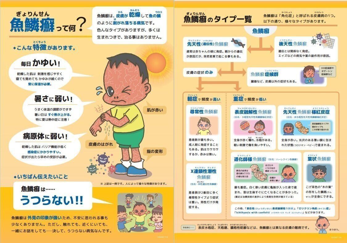 魚鱗癬: 皮膚疾患の原因と症状を理解する _ 尋常性魚鱗癬 病気事典 [家庭の医学] – IKOTNY