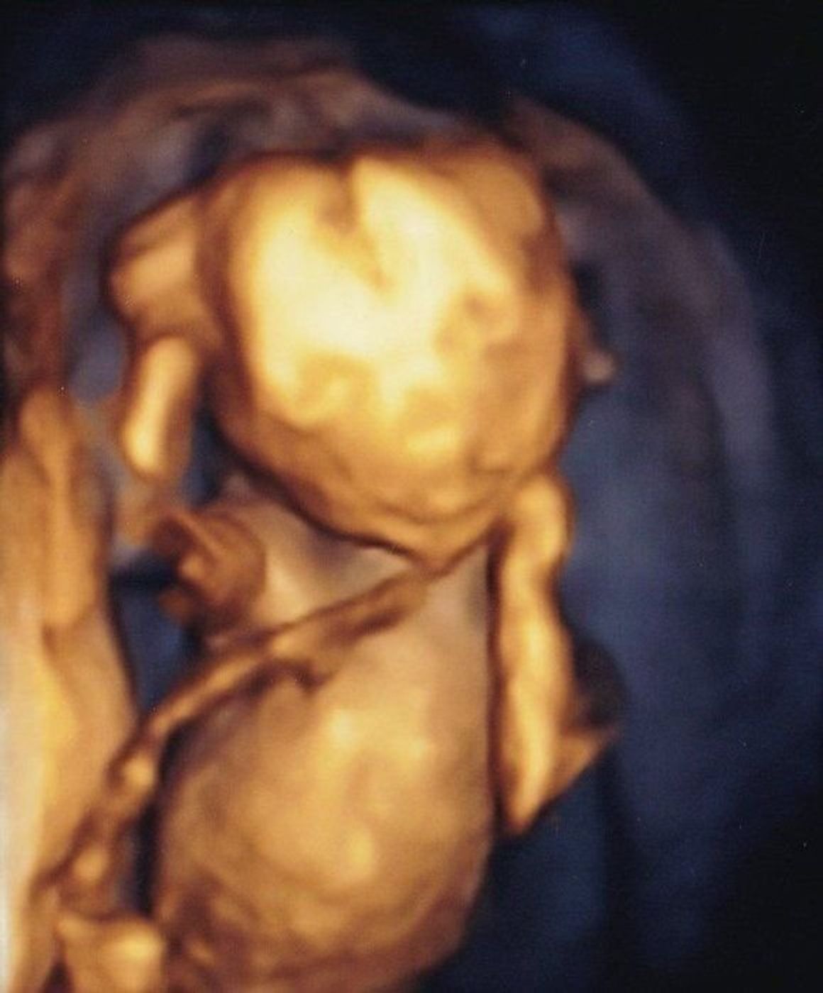 妊娠18週 赤ちゃんのエコー写真 超音波写真まとめ たまひよ 妊娠18週 赤ちゃんのエコー写真 超音波写真まとめ たまひよ