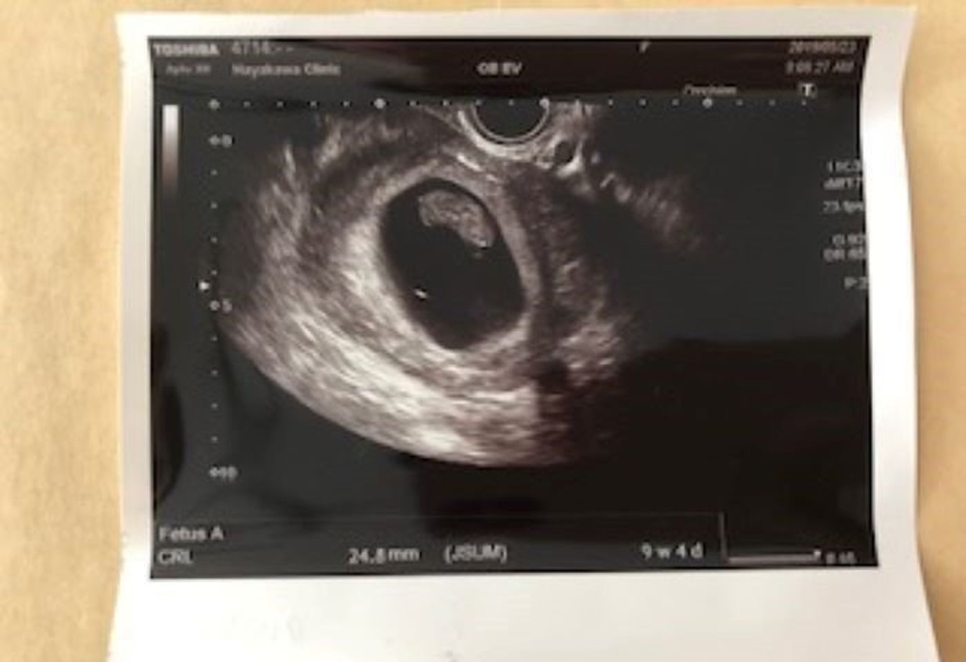 高齢妊娠 出産 エコー写真で振り返る第2子出産体験 たまひよ 高齢妊娠 出産 エコー写真で振り返る第2子出産体験 たまひよ