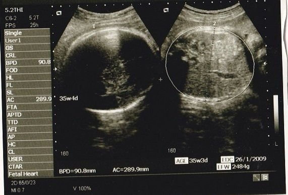 妊娠35週 赤ちゃんのエコー写真 超音波写真まとめ たまひよ 妊娠35週 赤ちゃんのエコー写真 超音波写真まとめ たまひよ