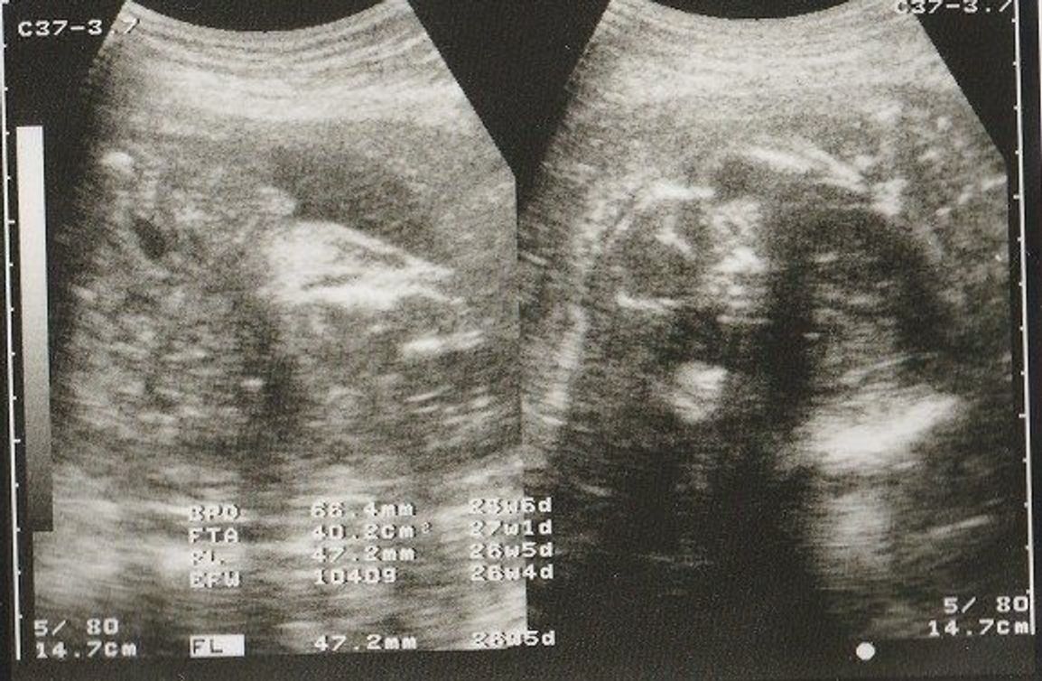 妊娠26週 赤ちゃんのエコー写真 超音波写真まとめ たまひよ 妊娠26週 赤ちゃんのエコー写真 超音波写真まとめ たまひよ