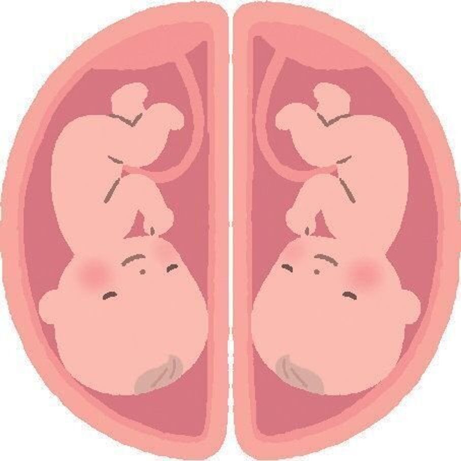 双子 三つ子になる理由は 一卵性と二卵性の違いって 専門家監修 たまひよ 双子 三つ子になる理由は 一卵性と二卵性の違いって 専門家監修 たまひよ