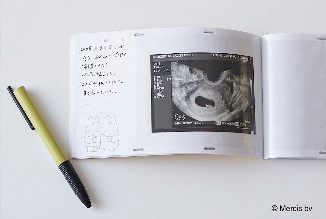 たまご「鳥の母子手帳」8冊 Amazon.co.jp: 母子健康手帳副読本 妊娠出産の本 たまごクラブ