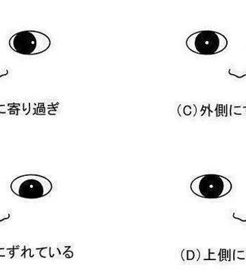 赤ちゃんの眼の病気 斜視の症状とケア 医師監修 たまひよ