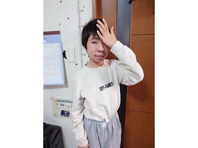 「おじいちゃん」を意味する修司くん独自のハンドサイン ※昔トランプをしているときにおじいちゃんがおでこにトランプを貼ったことから