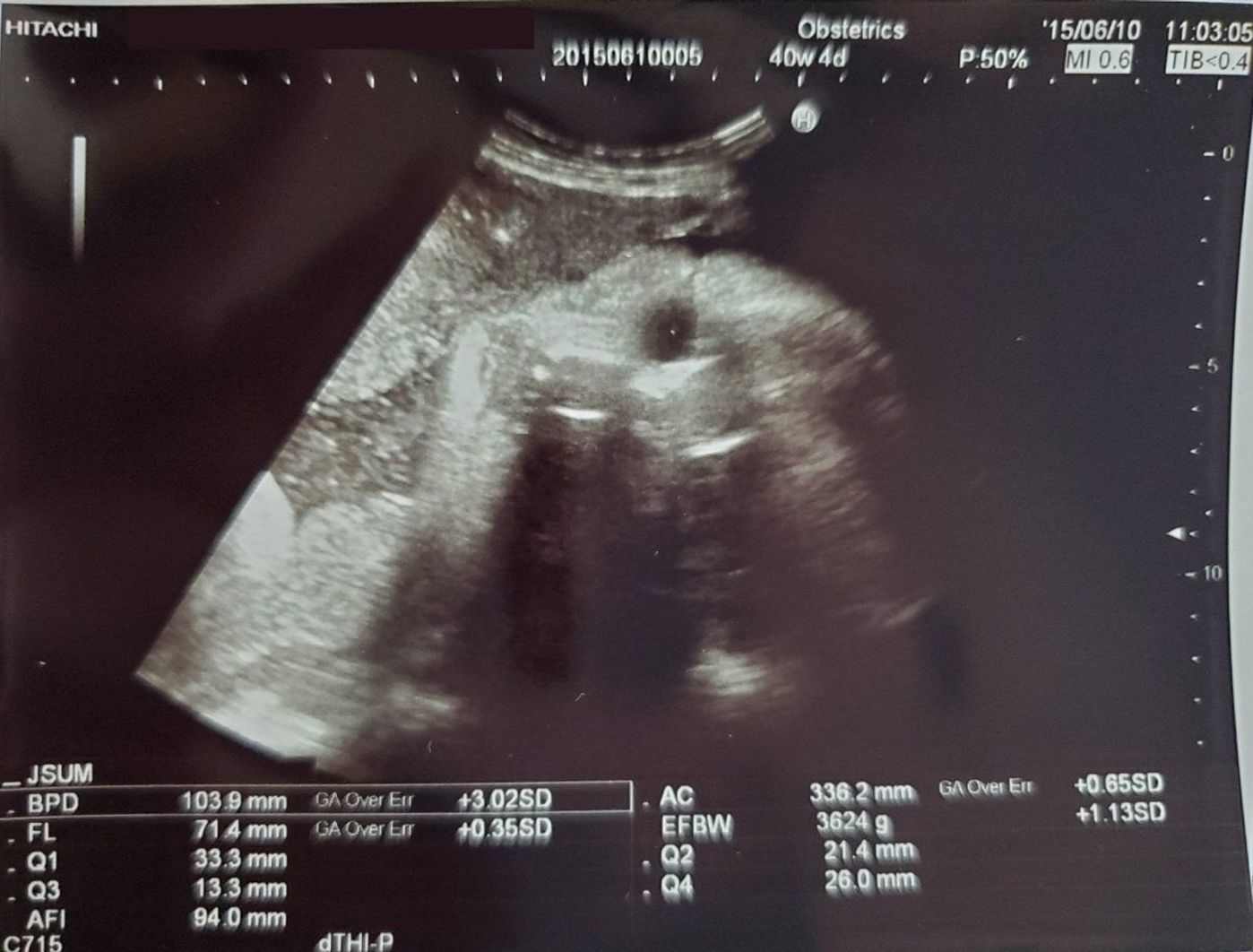 高齢 初出産でドキドキ エコー写真で振り返る成長の軌跡 たまひよ 高齢 初出産でドキドキ エコー写真で振り返る成長の軌跡 たまひよ